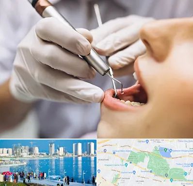 دندانپزشکی ارزان در چیتگر 