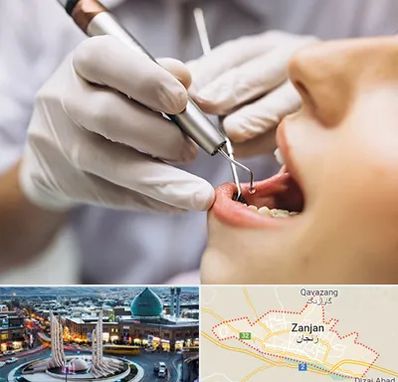 دندانپزشکی ارزان در زنجان