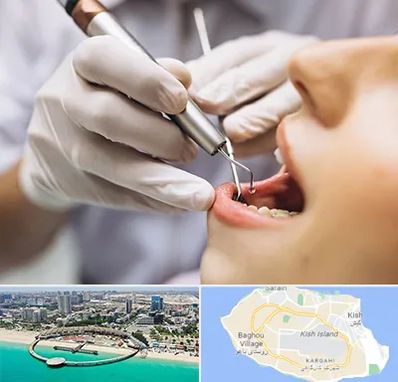 دندانپزشکی ارزان در کیش
