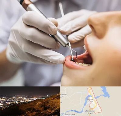 دندانپزشکی ارزان در میناب