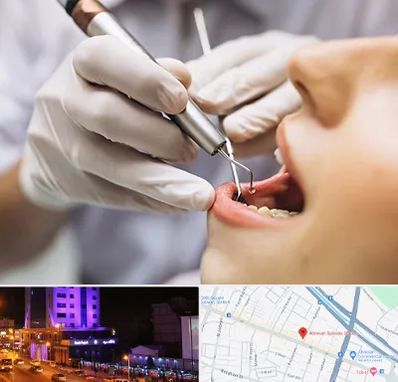 دندانپزشکی ارزان در آبرسان تبریز