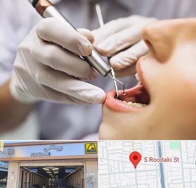 دندانپزشکی ارزان در رودکی