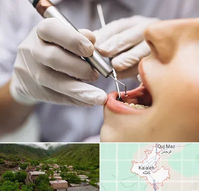 دندانپزشکی ارزان در کلاله