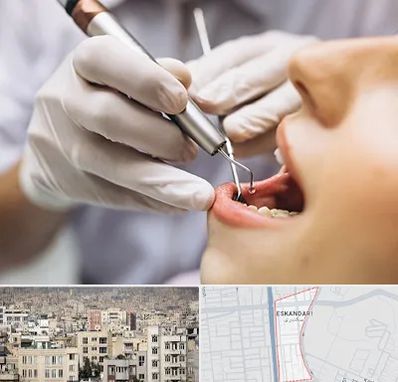 دندانپزشکی ارزان در اسکندری