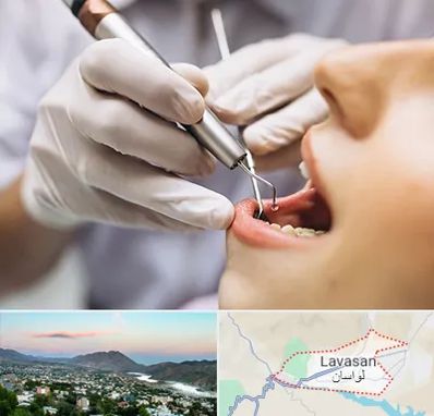 دندانپزشکی ارزان در لواسان