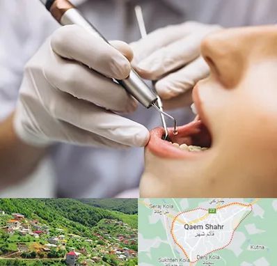 دندانپزشکی ارزان در قائم شهر