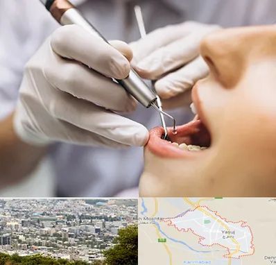 دندانپزشکی ارزان در یاسوج
