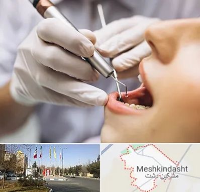 دندانپزشکی ارزان در مشکین دشت