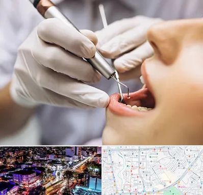 دندانپزشکی ارزان در منظریه رشت 