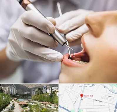 دندانپزشکی ارزان در بلوار تعاون