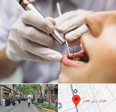 دندانپزشکی ارزان در ولیعصر شهریار