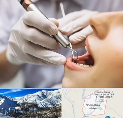 دندانپزشکی ارزان در شمشک