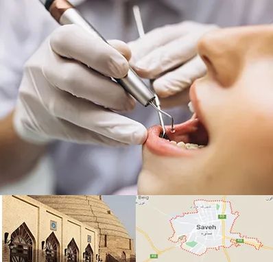 دندانپزشکی ارزان در ساوه