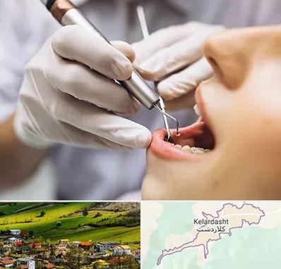 دندانپزشکی ارزان در کلاردشت