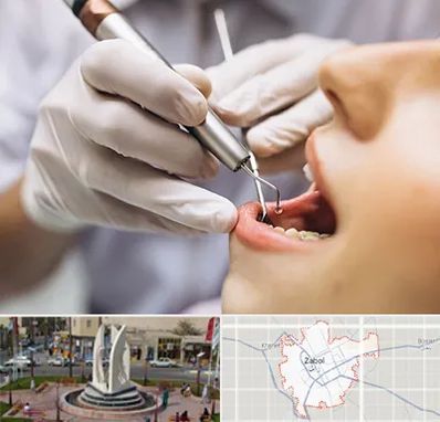 دندانپزشکی ارزان در زابل