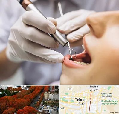 دندانپزشکی ارزان در ولیعصر 