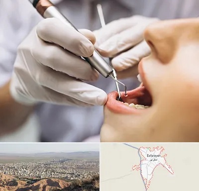دندانپزشکی ارزان در اسفراین
