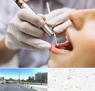 دندانپزشکی ارزان در بلوار کلاهدوز مشهد 