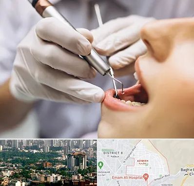 دندانپزشکی ارزان در عظیمیه کرج 