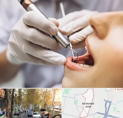 دندانپزشکی ارزان در کاشانک