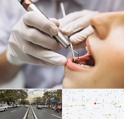 دندانپزشکی ارزان در دولت 