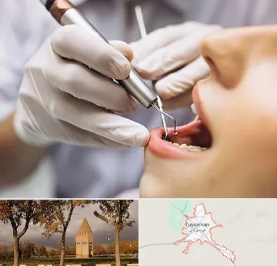 دندانپزشکی ارزان در تویسرکان
