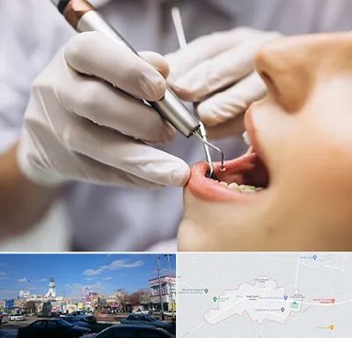 دندانپزشکی ارزان در ماهدشت کرج 