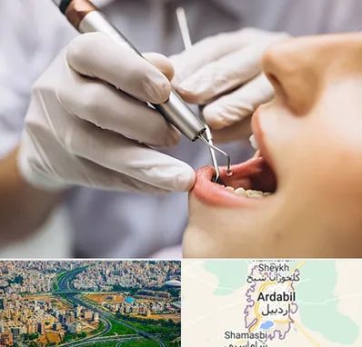 دندانپزشکی ارزان در اردبیل