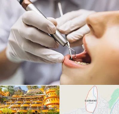 دندانپزشکی ارزان در دربند