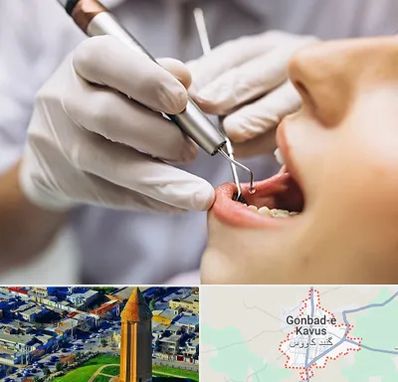 دندانپزشکی ارزان در گنبد کاووس
