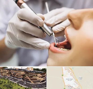 دندانپزشکی ارزان در شاهین شهر