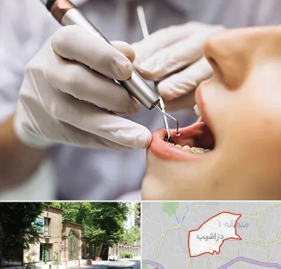 دندانپزشکی ارزان در دزاشیب