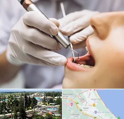 دندانپزشکی ارزان در رودسر