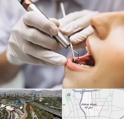 دندانپزشکی ارزان در عباس آباد تهران