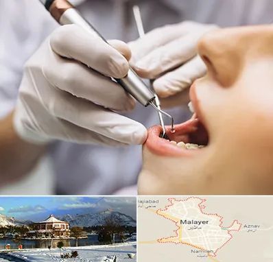 دندانپزشکی ارزان در ملایر