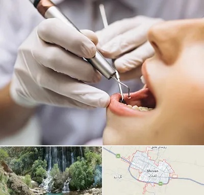 دندانپزشکی ارزان در شیروان