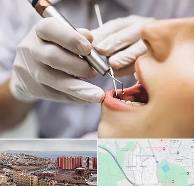 دندانپزشکی ارزان در سهند تبریز