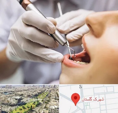 دندانپزشکی ارزان در شهرک گلستان