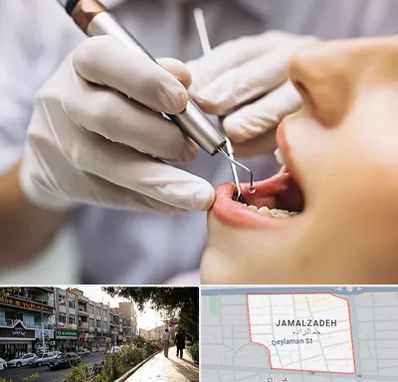 دندانپزشکی ارزان در خیابان جمالزاده