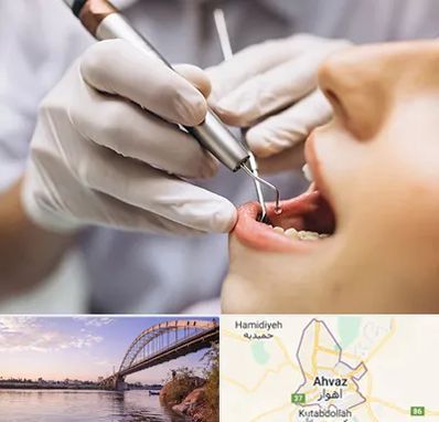 دندانپزشکی ارزان در اهواز