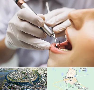 دندانپزشکی ارزان در بابل