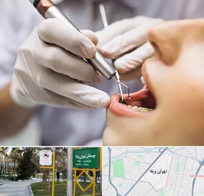 دندانپزشکی ارزان در تهران ویلا