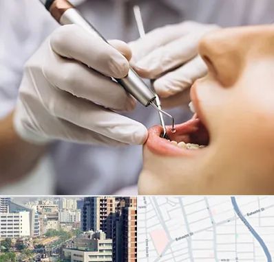 دندانپزشکی ارزان در خیابان بهشتی