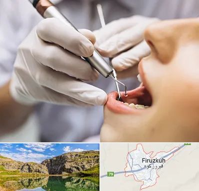 دندانپزشکی ارزان در فیروزکوه