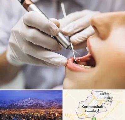 دندانپزشکی ارزان در کرمانشاه
