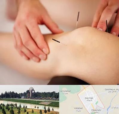 دکتر طب سوزنی برای لاغری در قرچک