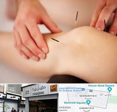 دکتر طب سوزنی برای لاغری در منیریه 