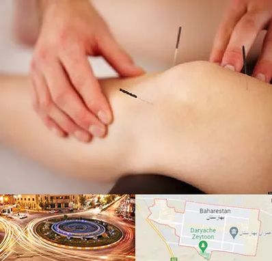 دکتر طب سوزنی برای لاغری در بهارستان