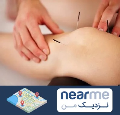 دکتر طب سوزنی برای لاغری در نزدیک من