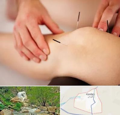 دکتر طب سوزنی برای لاغری در کردان